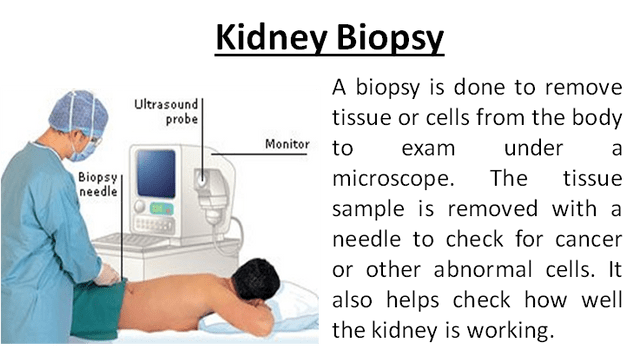 Kidney Biopsy