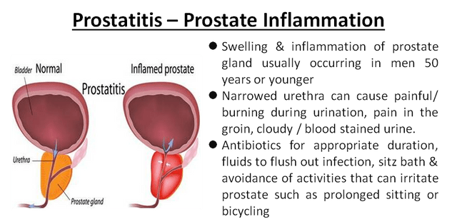 can prostatitis pain come and go