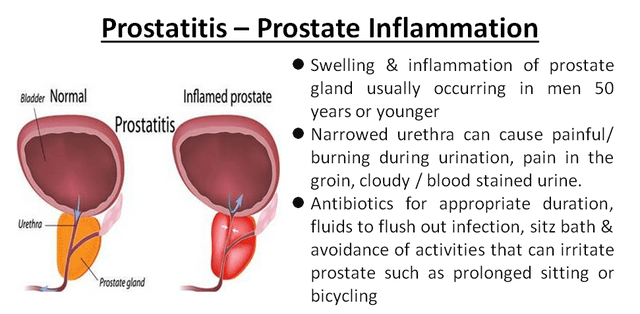 Prostatitis A betegség oka