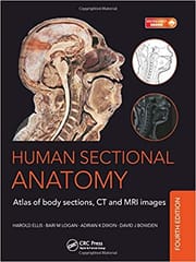 Human Sectional Anatomy Atlas Of Body Sections CT and MRI Images 4th Edition 2015 By Adrian K. Dixon Human Sectional Anatomy Atlas Of Body Sections CT and MRI Images 4th Edition 2015 By Adrian K. Dixon
