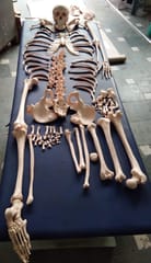 Disarticulated Human Skeleton Bilateral 200 Bones (Full Size 180 cm) High quality PVC Plastic