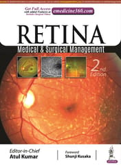RETINA Medical and Surgical Management 2nd Edition 2021 by Atul Kumar