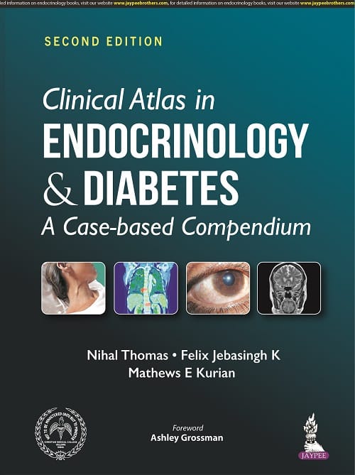 Clinical Atlas in Endocrinology & Diabetes A Case‐based Compendium 2nd Edition 2022 By Nihal Thomas