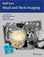 Radcases Head And Neck Imaging 1St Edition By Shah