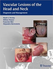 Vascular Lesions Of The Head And Neck By Persky
