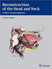 Reconstruction Of The Head And Neck By Genden