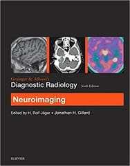 Grainger & Allison�S Diagnostic Radiology: Neuroimaging By Jager