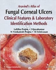 Aravind'S Atlas Of Fungal Corneal Ulcers Clinical Features & Lab.Identification Methods 1st Edition By Prajna