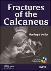 Fractures Of The Calcaneus With Dvd-Rom 1st Edition By Dhillon S Mandeep