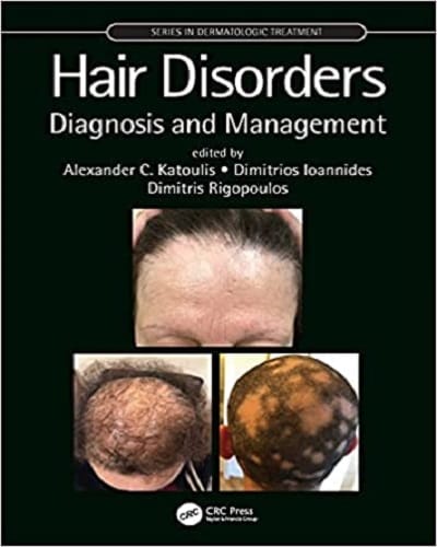 Hair Disorders Diagnosis and Management 2022 by Alexander C Katoulis