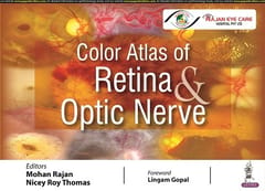Color Atlas of Retina & Optic Nerve 1st Edition 2022 by Mohan Rajan