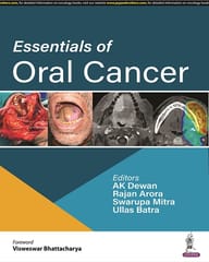 Essentials of Oral Cancer 1st Edition 2022 by AK Dewan