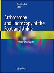 Arthroscopy and Endoscopy of the Foot and Ankle: Principles and Practice 2019 By Lui Publisher Springer