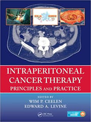 Intraperitoneal Cancer Therapy: Principles and Practice 2016 By Ceelen Publisher Taylor & Francis