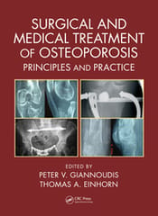 Surgical And Medical Treatment Of Osteoporosis Principles And Practice 2020 By Giannoudis P.V. Publisher Taylor & Francis