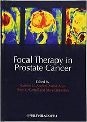 Focal Therapy in Prostate Cancer 2012 By Ahmed Publisher Wiley