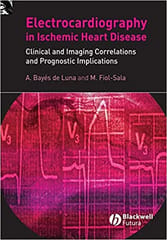Electrocardiography in Ischemic Heart Disease: Clinical & Imaging Correlations & Prognostic Implications 2008 By Bayes De Luna Publisher Wiley