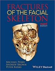 Fractures of The Facial Skeleton 2nd Edition 2015 By Perry M Publisher Wiley