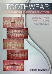 Toothwear: The ABC of the Worn Dentition 2011 By Khan Publisher Wiley