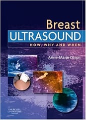 Breast Ultrasound 1st Edition 2007 By Dixon
