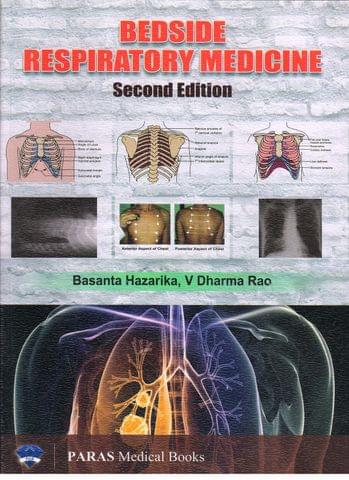 Bedside Respiratory Medicine 2nd edition 2017 by Basanta Hazarika
