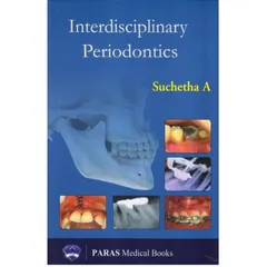 Interdisciplinary Periodontics 1st edition 2018 by Suchetha A