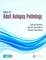 Atlas of Adult Autopsy Pathology 2015 By Julian Burton