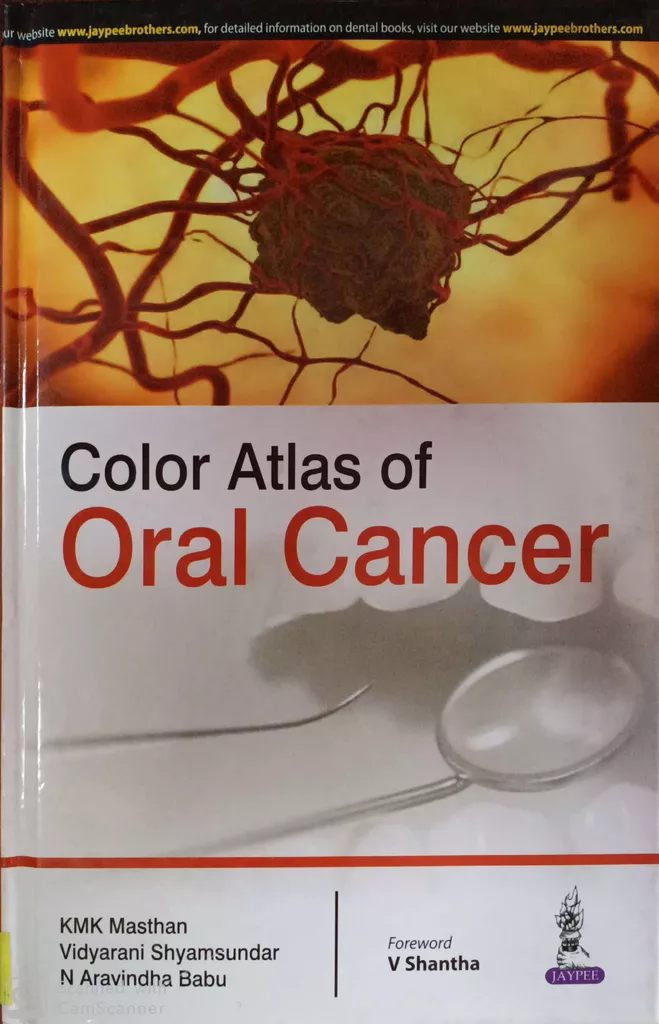 Color Atlas of Oral Cancer 2016 by K.M.K  Masthan