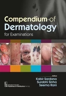 Compendium of Dermatology  for Examinations 1st Edition 2019 By (Kabir Sardana | Surabhi Sinha | Seema Rani)