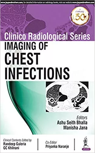Clinico Radiological Series: Imaging of Chest Infections 1st Edition 2019 By Ashu Seith Bhalla