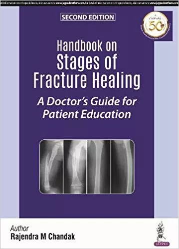 Handbook on Stages of Fracture Healing: A Doctor's Guide for Patient Education 2nd Edition 2019 By Rajendra M Chandak
