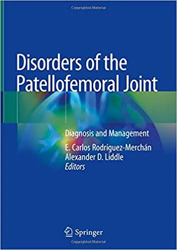 Disorders of the Patellofemoral Joint: Diagnosis and Management 2019 By E.Carlos Rodr__guez-Merch__n