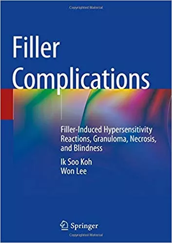 Filler Complications: Filler-Induced Hypersensitivity Reactions, Granuloma, Necrosis, and Blindness 2019 By Ik Soo Koh