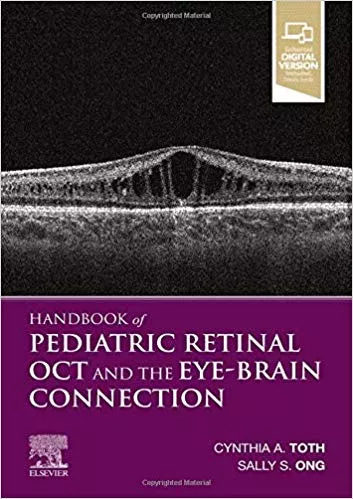 Handbook of Pediatric Retinal OCT and the Eye-Brain Connection 2020 By Toth MD, Cynthia A