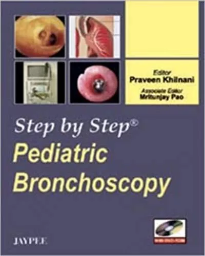 STEP BY STEP PEDIATRIC BRONCHOSCOPY WITH DVD-ROM(PAPERBACK)