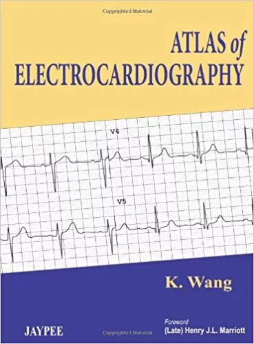 ATLAS OF ELECTROCARDIOGRAPHY(PAPERBACK)
