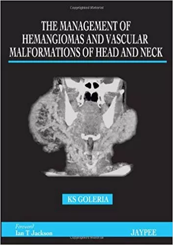 THE MANAGEMENT OF HEMANGIOMAS AND VASCULAR MALFORMATIONS OF HEAD AND NECK(HARDCOVER)