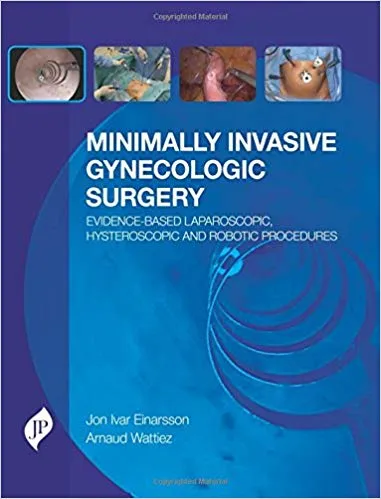 Minimally Invasive Gynecologic Surgery Evidence-Based Lap.Hyster And Robotic Procedures 2016 by Einarsson Jon Ivar