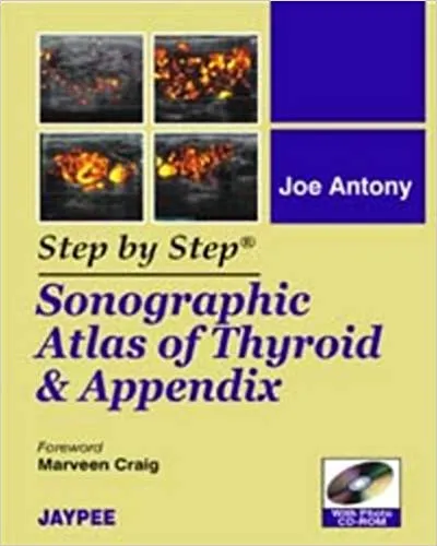 STEP BY STEP SONOGRAPHIC ATLAS OF THYROID & APPENDIX WITH PHOTO CD-ROM(PAPERBACK)