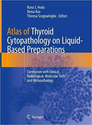 Atlas of Thyroid Cytopathology on Liquid-Based Preparations 2020 By Rana S. Hoda