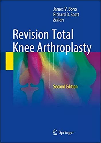 Revision Total Knee Arthroplasty 2018 By James V. Bono