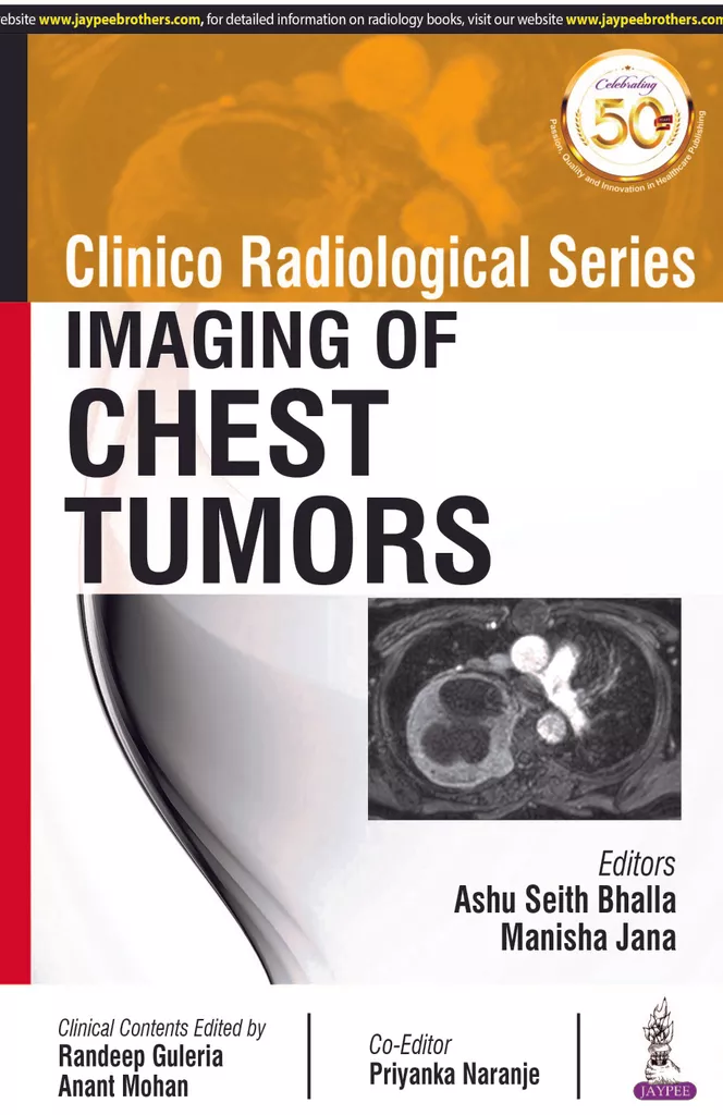 Clinico Radiological Series Imaging Of Chest Tumors 1st Edition 2020 By Ashu Seith Bhalla & Manisha Jana