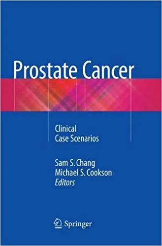 Prostate Cancer: Clinical Case Scenarios 2019 By Sam S. Chang