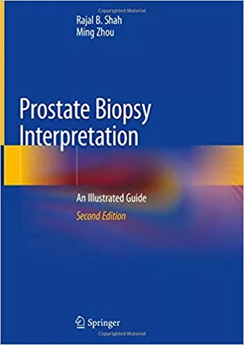 Prostate Biopsy Interpretation: An Illustrated Guide 2019 By Rajal B. Shah