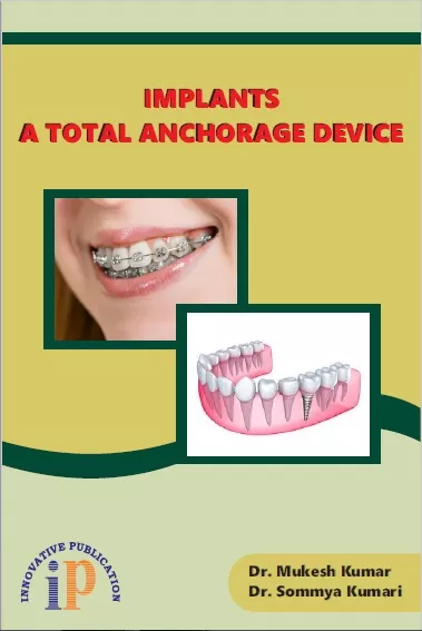 Implants - A Total Anchorage Device, First Edition, 2019, By Dr. Mukesh Kumar, Dr. Sommya Kumari