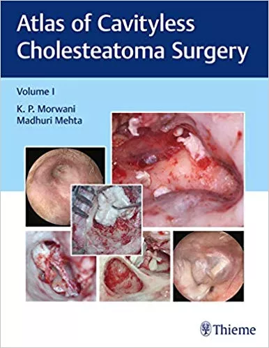 Atlas of Cavityless Cholesteatoma Surgery (Volume 1) 2017 By K.P. Morwani