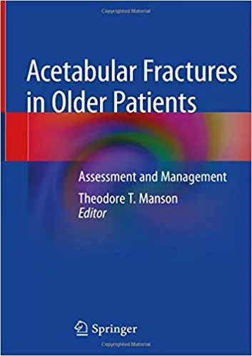Acetabular Fractures in Older Patients: Assessment and Management 2020 By Theodore T. Manson