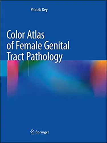 Color Atlas of Female Genital Tract Pathology 2019 By Pranab Dey