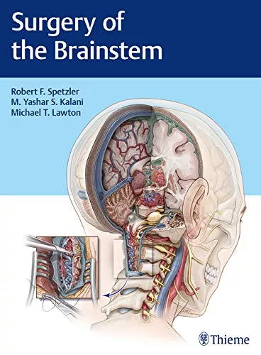 Surgery of the Brainstem 1st Edition 2020 By Robert F. Spetzler