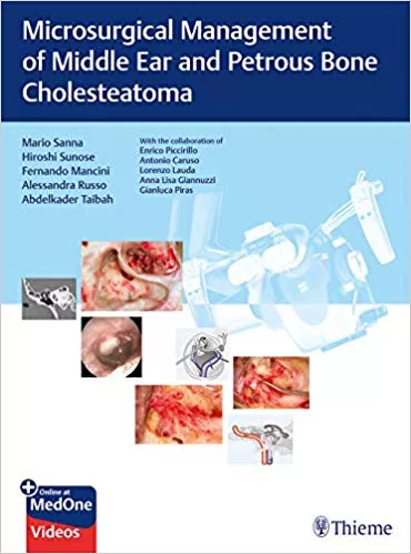 Microsurgical Management of Middle Ear and Petrous Bone Cholesteatoma 1st Edition 2019 By Mario Sanna